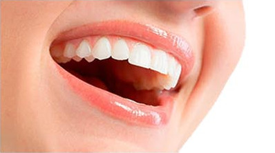 Отбеливание зубов в клинике AV Klinik